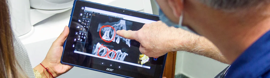 FC – Dental Implants at Paradise Dental Arts, Oxnard, CA